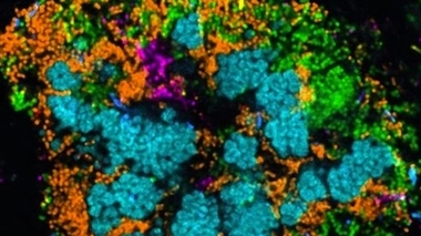 Des bactéries colonisent votre bouche - Photo©Jessica Mark Welch and Gary Borisy/PNAS