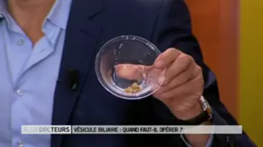 Calculs biliaires : existe-t-il une alternative à l'opération ?