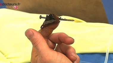 Accidents du travail : des associations s'inquiètent d'une baisse des barèmes d'indemnisation