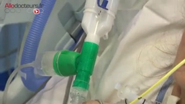 Réanimation : pédaler en étant alité