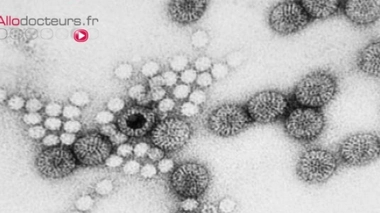 Le norovirus est le principal virus de la gastro-entérite.