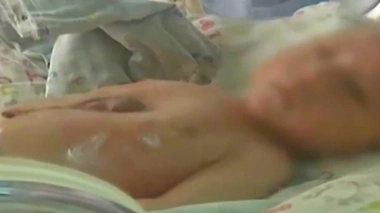 Extrait de la vidéo d'un enfant chinois atteint de la pentalogie de Cantrell.