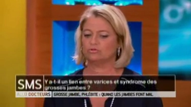 Y a-t-il un lien entre varices et syndrome des grosses jambes ?