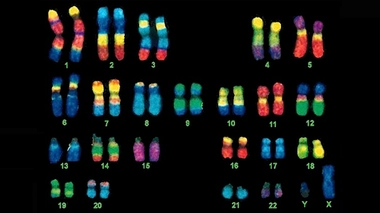 Un caryotype (image d'illustration)