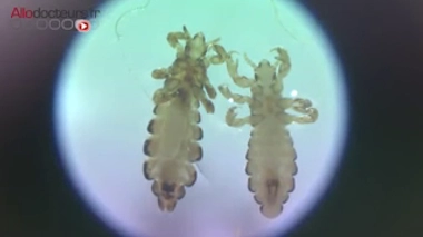 Un aspirateur pour en finir avec les poux