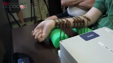 Un tétraplégique bouge la main grâce à une puce implantée dans son cerveau