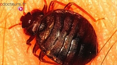 Les punaises de lits craquent pour le rouge et le noir