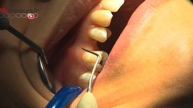 L'inspection générale des affaires sociales saisie du dossier des centres dentaires Dentexia