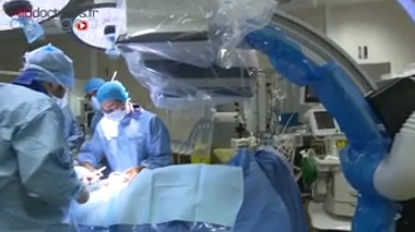 Une imagerie 3D pour remplacer l'aorte