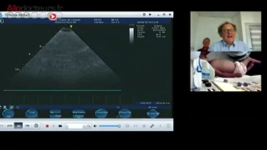 Médecine humanitaire : réaliser une échographie à distance