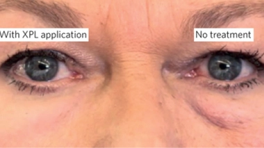 Image comparative avec XPL et sans traitement ©Nature