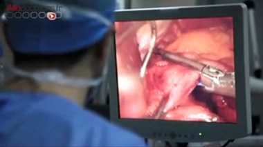 Quand la chirurgie de l'obésité échoue