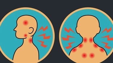 Douleurs des maladies neurodégénératives (Photo Fotolia - © ilovecoffeedesign)