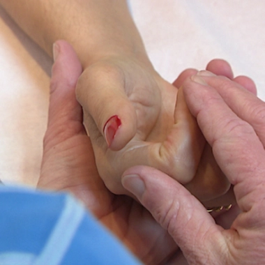 Algodystrophie, la douleur des organes mal irrigués