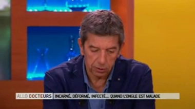 Mycose de l'ongle : quel traitement ?