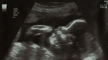 Image d'illustration © Nelly Kovalchuk - Fotolia.com