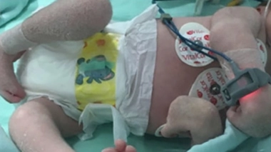 Contracture articulaire dans les jambes et les bras