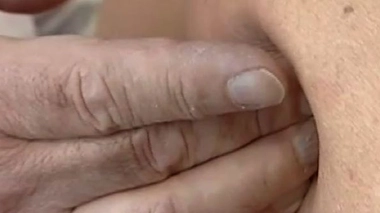 Ch@t : L'ostéopathie