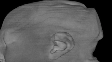 Les ravages de Zika en images - 