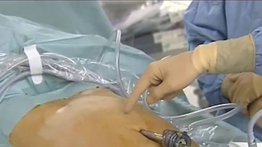 Mort d'un enfant après une opération à Metz : deux médecins mis en examen