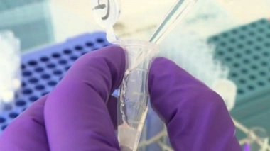 Pollution de l'air : des nanoparticules retrouvées dans le cerveau