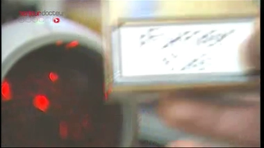 Cancer du poumon : la piste génétique pour les non-fumeurs