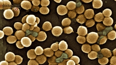 Staphylocoque doré : la réserve sanitaire intervient en Guyane