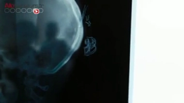 Le secret médical est-il menacé ?