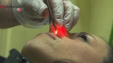 Sinusite et risque de cancer : l'art de détourner une étude sérieuse