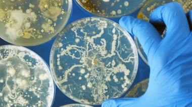 La résistance aux antibiotiques pourrait tuer 700.000 personnes par an dans le monde - 