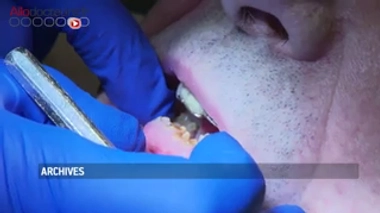 Des soins dentaires vraiment trop chers