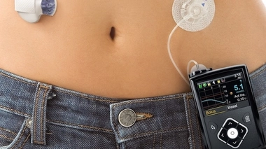 Le pancréas artificiel MiniMed 670G, désormais autorisé outre-Atlantique. (crédits : Medtronic)