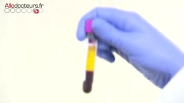 Mieux dépister la prédisposition génétique aux cancers du sein et des ovaires