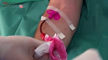 Les porteurs de certaines mutations génétiques associées à de forts taux de LDL ont un risque de maladies cardiovasculaires multiplié par 100.