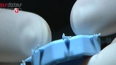 Quand les osselets ne se font plus entendre