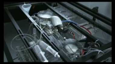 Coeur artificiel : essais suspendus après le décès du cinquième patient