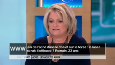 Acné dans le dos et sur le torse : le laser est-il une solution ?
