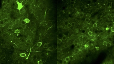 Activité neuronale dans le cortex préfrontal de contrôle (à gauche) et dans un cortex exprimant la mutation humaine CHRNA5 (à droite). Crédits : Institut Pasteur (https://youtu.be/NE3-AFRoMM4).