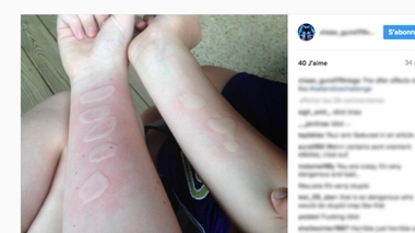 "Ice and salt challenge" : un défi dangereux qui inquiète les autorités