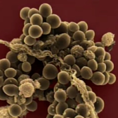 Staphylocoque doré : une bactérie sous surveillance