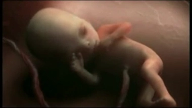 Asthme et césarienne : préserver la flore intestinale du foetus