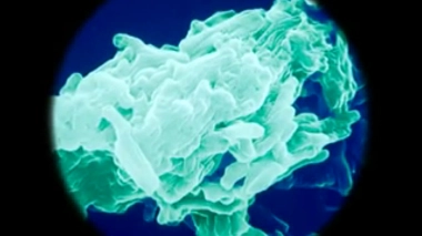 Bretagne : une fillette meurt d'une méningite tuberculeuse