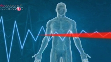 Infarctus du myocarde : y a-t-il toujours des signes avant-coureurs ?