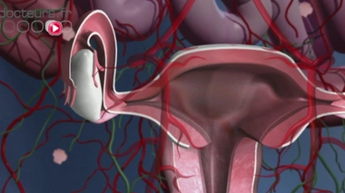 Endométriose : informer pour permettre un diagnostic précoce