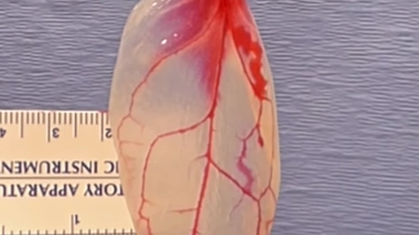 Les coeurs du futur seront-ils réparés avec des feuilles d'épinard ? (Image extraite de la vidéo WPI - YouTube)