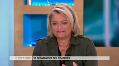 Comment traiter une cicatrice chéloïde ?