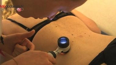 Cancers de la peau : prenez rendez-vous pour un dépistage gratuit !
