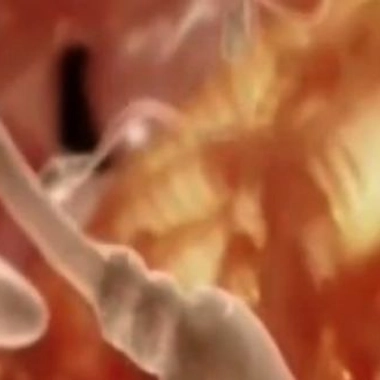 Infertilité masculine : des solutions pour une fécondation