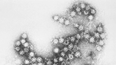 Maladie non identifiée au Liberia : des tests positifs à la méningite