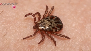 Le nombre de victimes de la maladie de Lyme est estimé à 27.000 par an en France